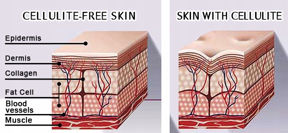 profesjonalne ampułki na CELLULIT, - 40% taniej EAN (GTIN) 8432729009477