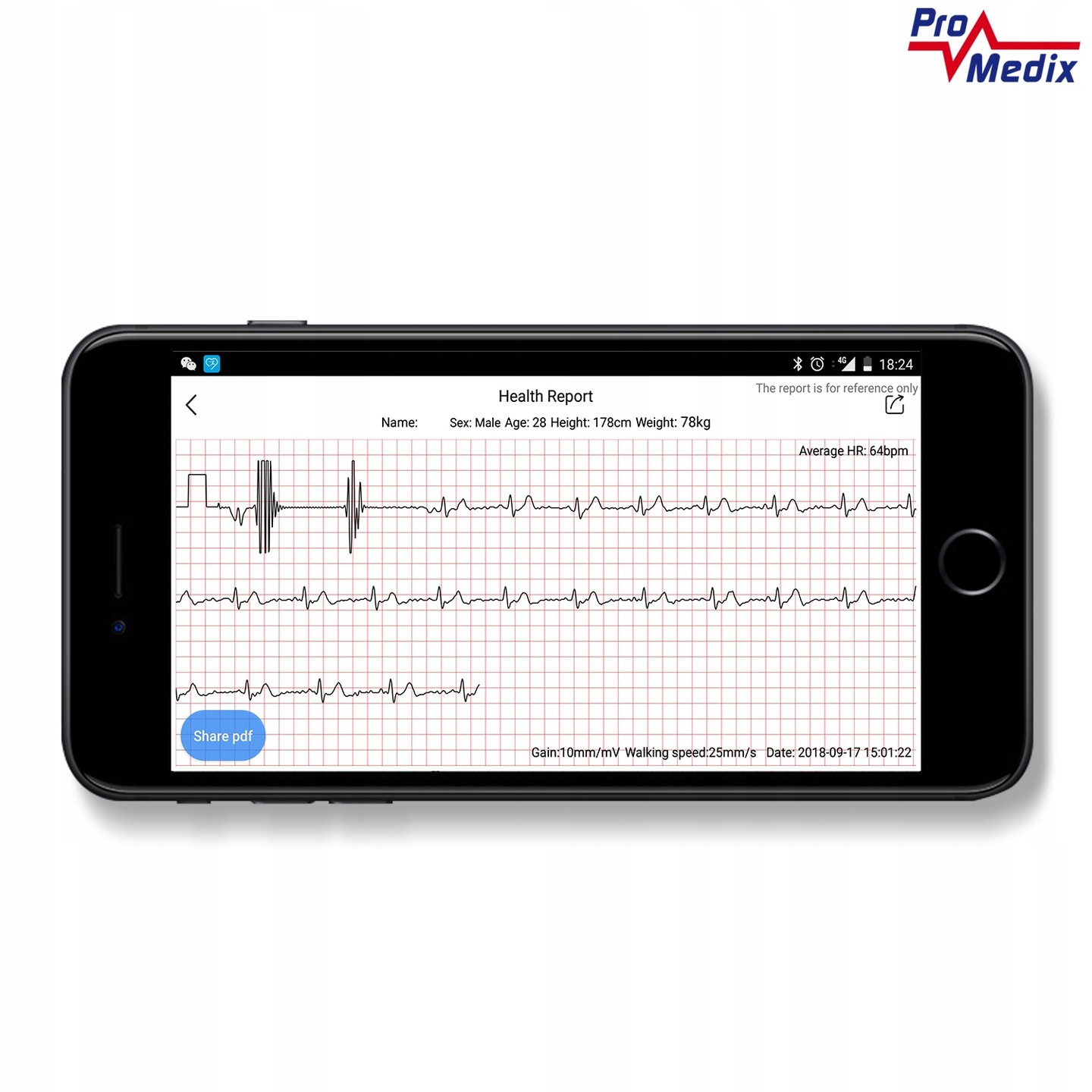 Opaska Fitness Tracker Smartband Bluetooth Puls EKG Promedix PR650 ECG