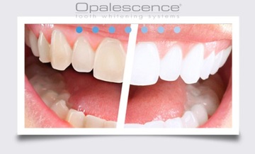 OPALESCENCE GO_READY НАКЛАДЫВАЕТСЯ С GEL_SELECTED. ЗУБ