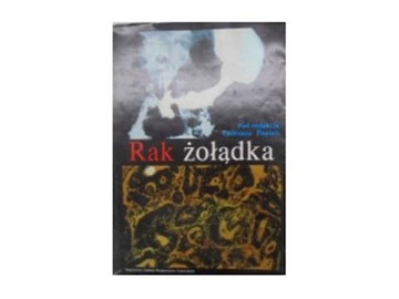 Rak żołądka - pod red. T. Popieli 1987 24h wys