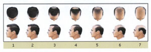 Шампунь Hair Force One для ускорения роста волос 1л