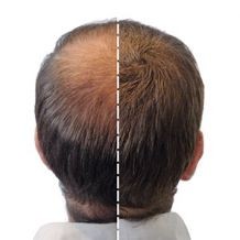 Hair Plus 12g Zagęszczanie Mikrowłókna NOWOŚĆ