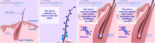 Redecteur de Pilosite, Борьба с луковицами волос на лице, выпадением волос